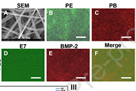 山东大学附属省立医院满振涛Colloids Surf. B Biointerfaces：功能性电纺支架同时促进骨髓间充质细胞的粘附和成骨分化