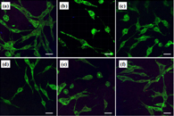 J. Mater. Sci. Mater. Med.：纳米纤维双组分支架双重递送NGF和GDNF及其生物学效应